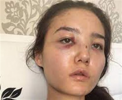 Казахстанский дипломат избивал жену - полиция завела на него уголовное дело